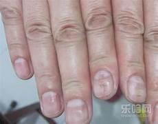 黑皮指的是什么人